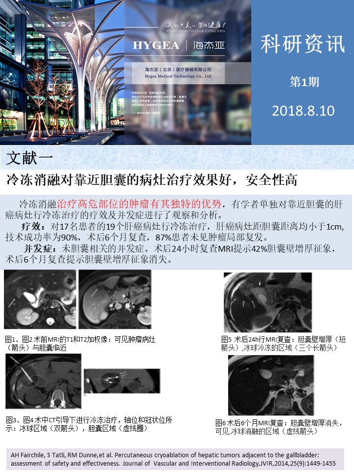 【海杰亞科研資訊】第1期——肝、肺癌消融